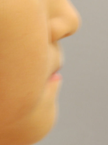 %e9%a1%94%e3%80%80%e5%88%9d%e8%a8%ba